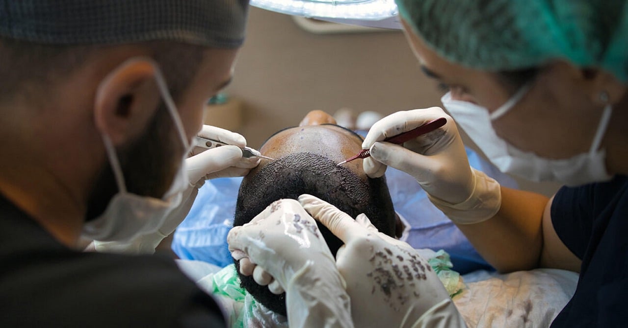 Hair Transplant Clinic SEO Case Study: 34% Traffic Growth